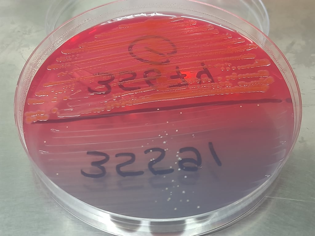 Kolonier av shigella-bakterier som vokser på en agarplate i et laboratorium