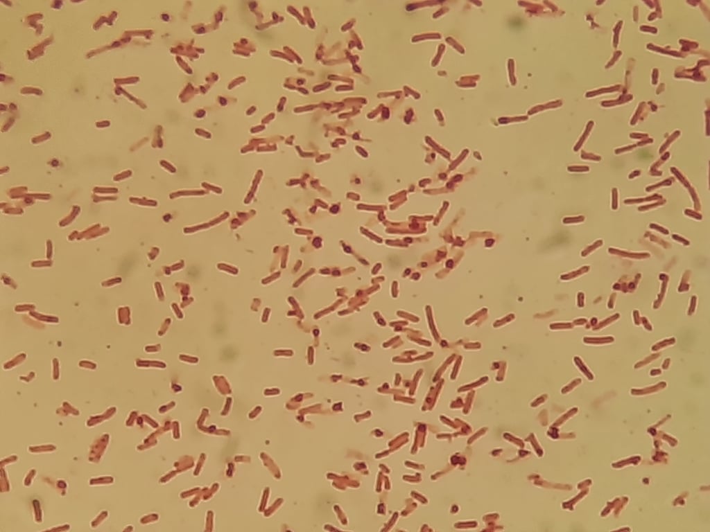 Stavformede shigella-bakterier farvet rosa, sett gjennom mikroskop